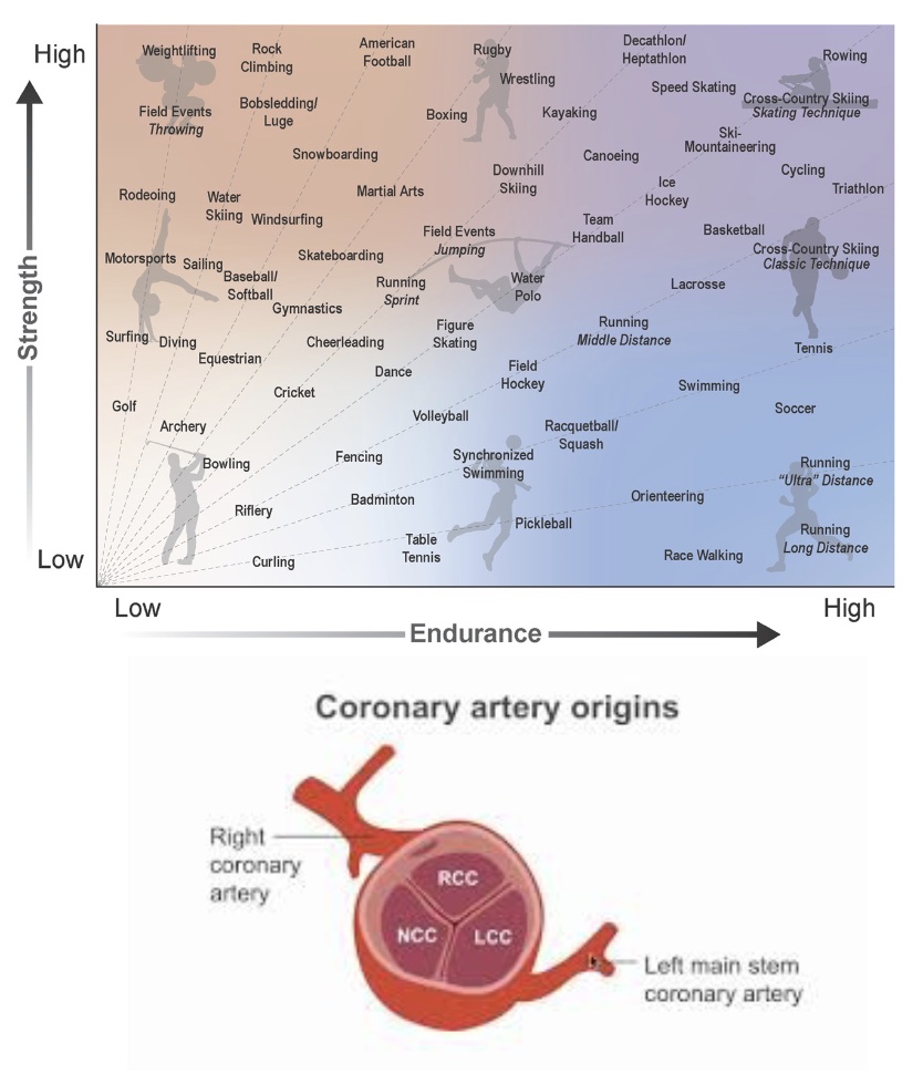 <p>-RT is effective; but don’t do 1RM or isometric (valsulva/high pressure; so do 5-10RM to assess)</p><p>-Coronary artery disease, heart failure, hypertension, hypercholestermia, valve disease (atherosclerosis)</p><p><u>Is strength assessment and training safe or appropriate?</u></p><p>-CAD and Heart Failure: used to say don’t push; n<strong>ow know RT increases P but decreases HR, so really effective bc CA get lots of blood; little risk if done right (higher reps and low volume)</strong></p><p>*CA: off aortic valve, higher HR=more systole and less filling of CA → heart attack (fill cusps when relaxes/dystole)</p><p>-Hypertension: RT helps control or lower BP</p><p>-Hypercholesteremia: no great data for RT, know RT increases muscle mass=increase metabolic activity; aerobic better to lower LDL</p><p>-Heart Valve Disease: RT distorts valves quicker, so not good</p>