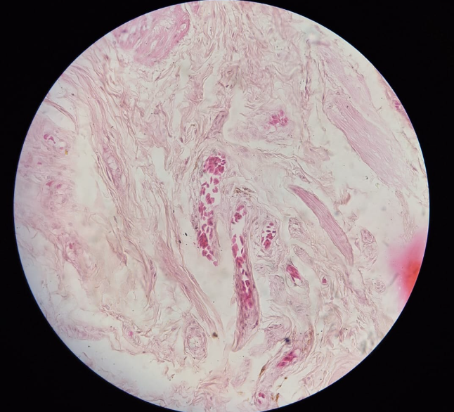 term image