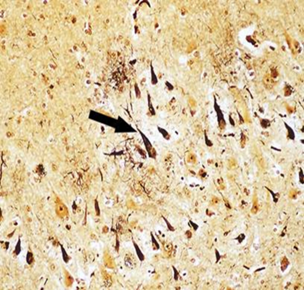 <p>•The hippocampus is necessary for the formation of new explicit (Semantic and Episodic) long-term memories. It helps organize the distributed representation regarding a memory from the different areas of the brain (vision, smell, hearing, touch, taste, emotion)</p><p>•Damage to the hippocampus causes an inability to form new explicit declarative (semantic and episodic) memories; Anterograde Amnesia (ex. Patient EP and HM)</p>