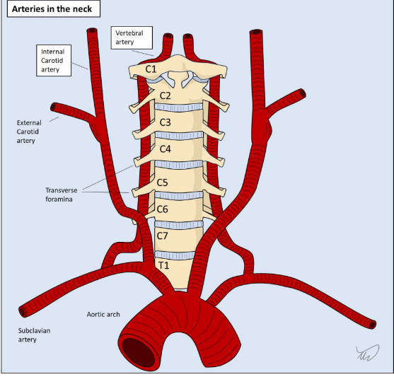 <p>It travels within the bony foramina of the cervical spine</p>