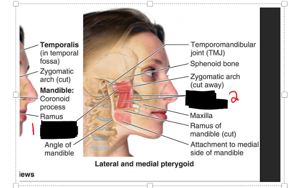 <p>Name the muscles.</p>