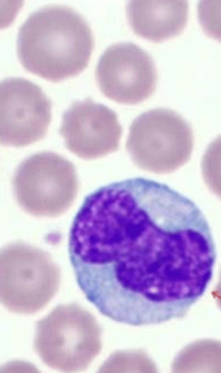 <p>what leukocyte is this?</p>
