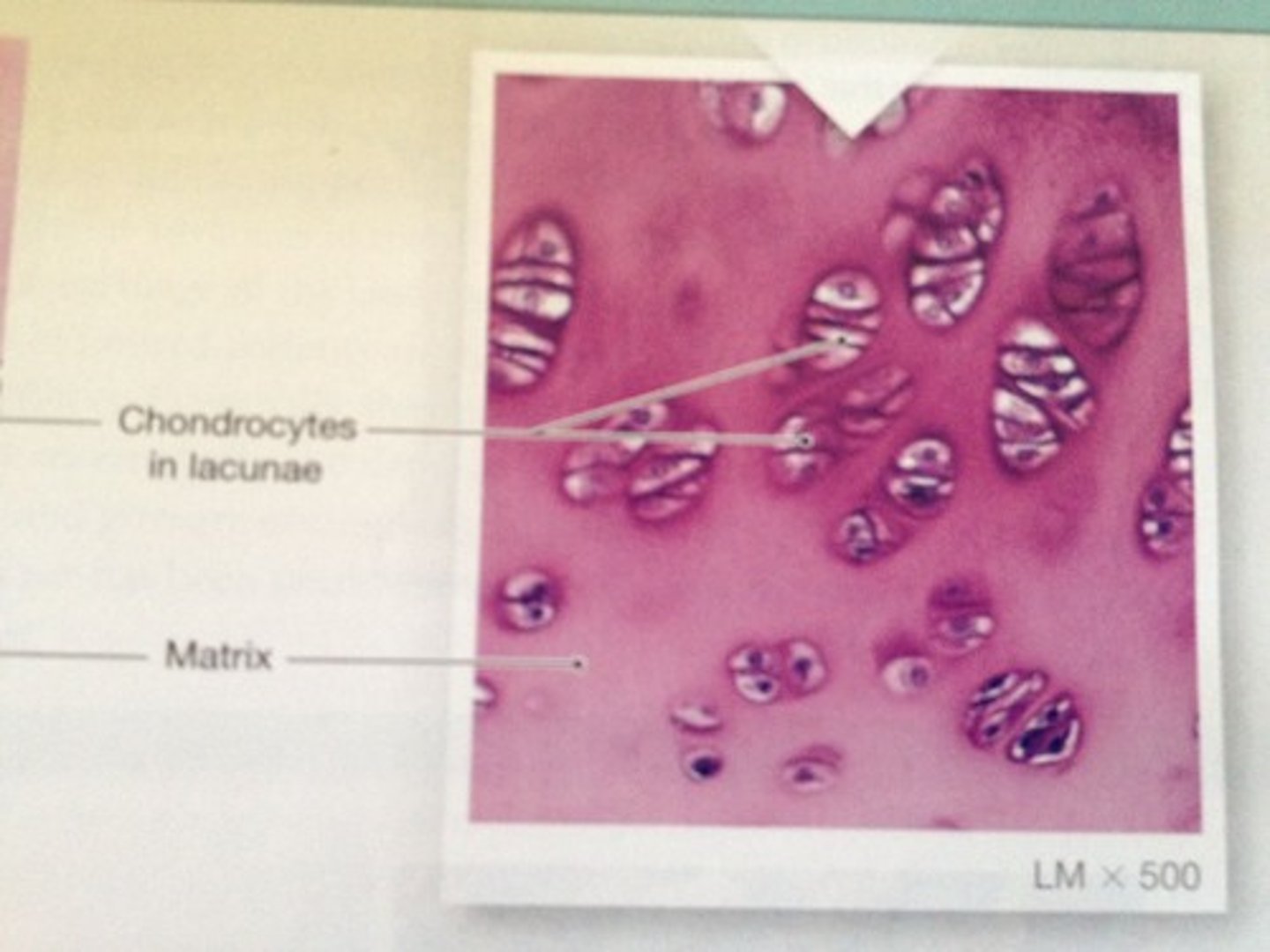 <p>Amorphous but firm matrix; collagen fibers form an imperceptible network; chondroblasts produce the matrix and, when mature, lie in lacunae.</p>