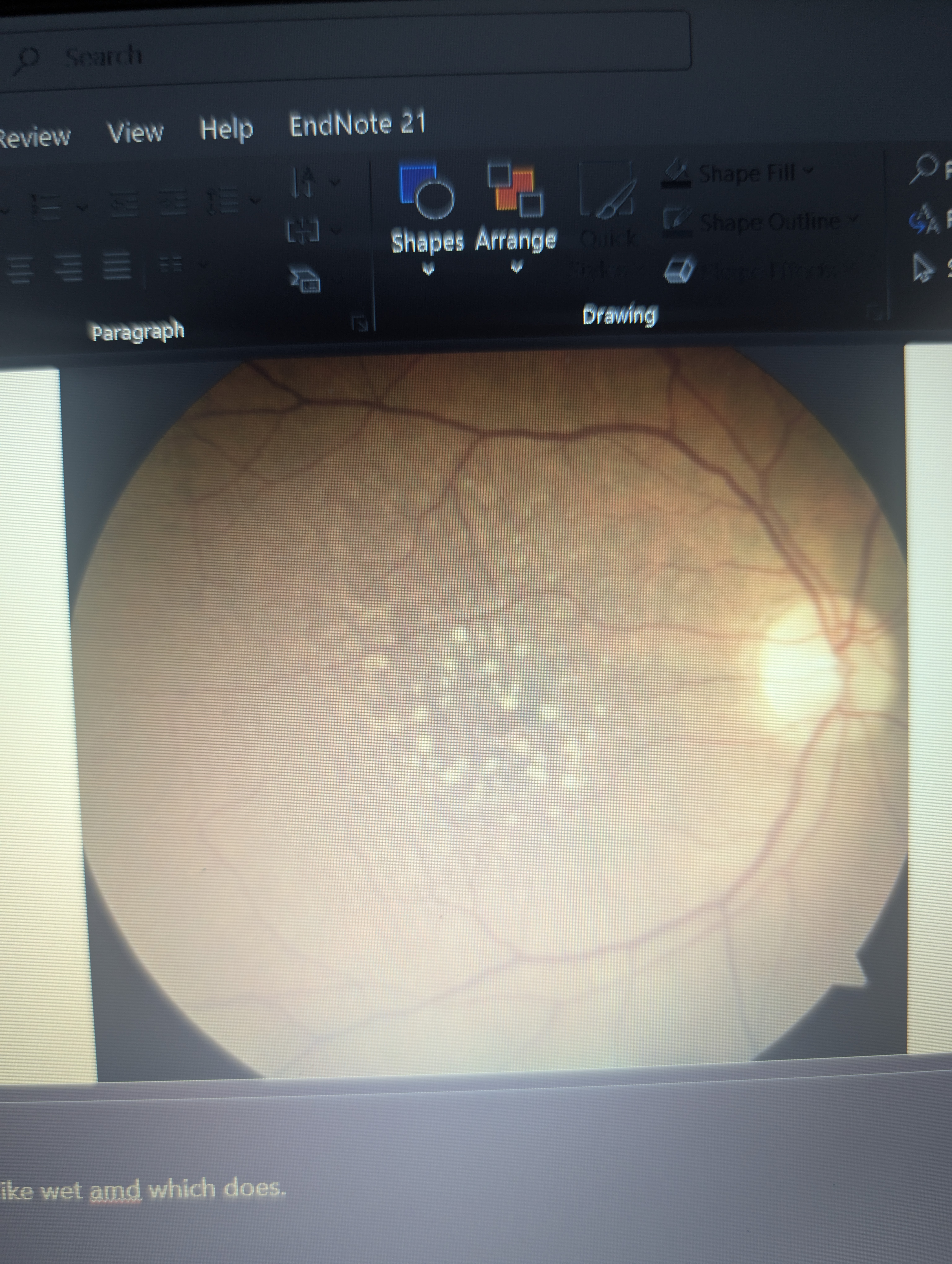 <p>What is this pathology?</p>