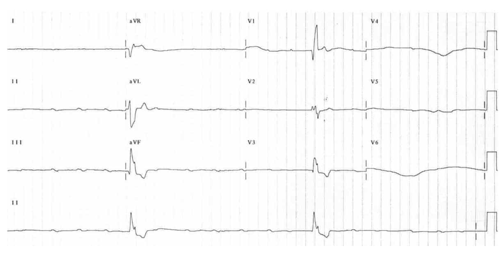 <p>Treatment plan for 3rd degree</p>