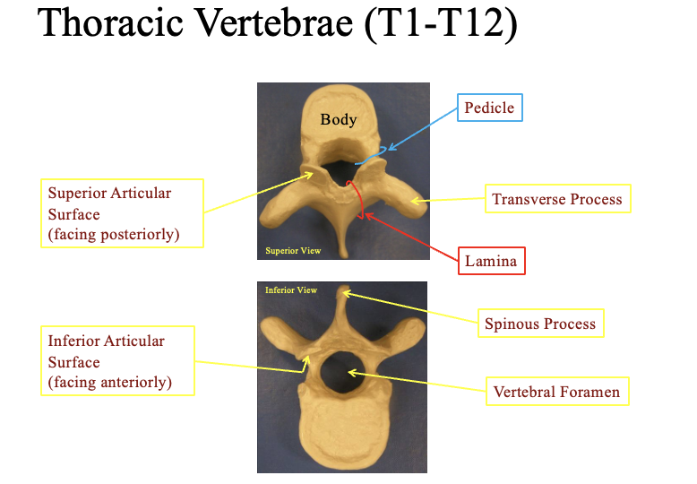 <ul><li><p>note that to tell it looks like a young moose&nbsp;</p></li></ul><p>posterior = with the pointy part facing backwards out your spine</p><p></p><p>Superior articular surface (faces posteriorly)-</p><ul><li><p>flat ridged bumps above the pointy parts</p></li></ul><p>inferior articular surface</p><ul><li><p>the inner part of the bumps facing the hollow shell of the vertebrae</p></li></ul><p>pedicle</p><ul><li><p>cercumferance area by the body</p></li></ul><p>Transverse process</p><ul><li><p>transverse process = the horned areas on two sides</p></li></ul><p>spinous process</p><ul><li><p>the most posterior part jutting out</p></li></ul><p>Vertebral foramen&nbsp;</p><ul><li><p>the hollow center</p></li></ul><p></p><p>Lateral view: where the ribs connect</p><ul><li><p>by the body you have two facetts for the head of the rib</p></li><li><p>on the transverse processes = facet for tubercle of rib</p></li></ul><img src="https://knowt-user-attachments.s3.amazonaws.com/9a422da7-f1cb-4c2d-b3c4-eb9da75d7303.png" data-width="100%" data-align="center"><p></p>