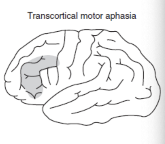<p>Comprehension/repetition preserved, production impaired</p>