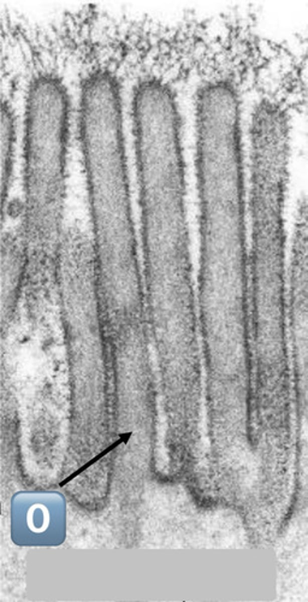 <p>gray square?</p>