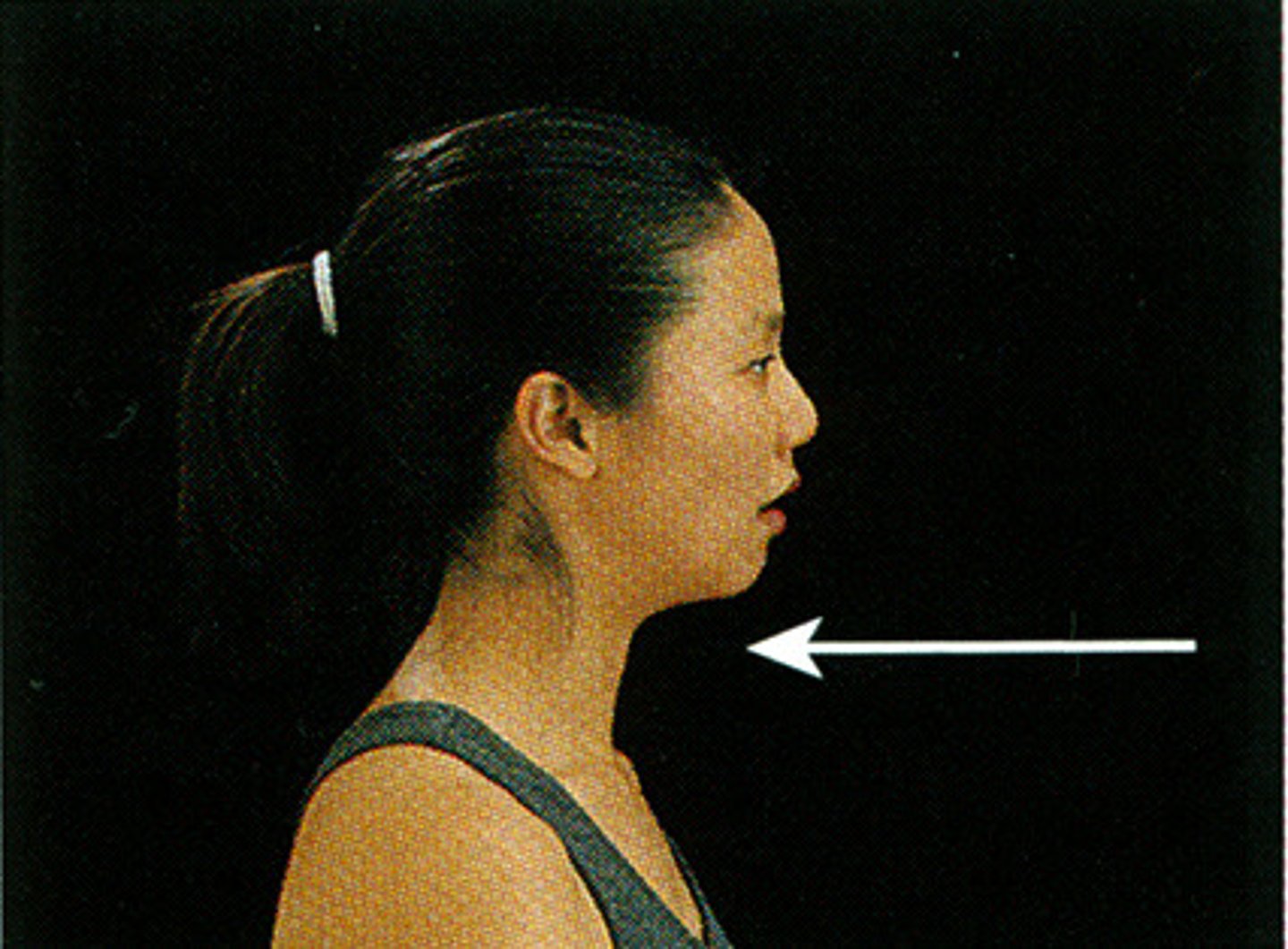 <p>Jaw in and squaring of the shoulders</p>