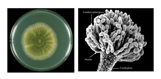 <ul><li><p>Mycotoxins</p></li><li><p>Mycotoxicosis</p></li></ul><p></p>