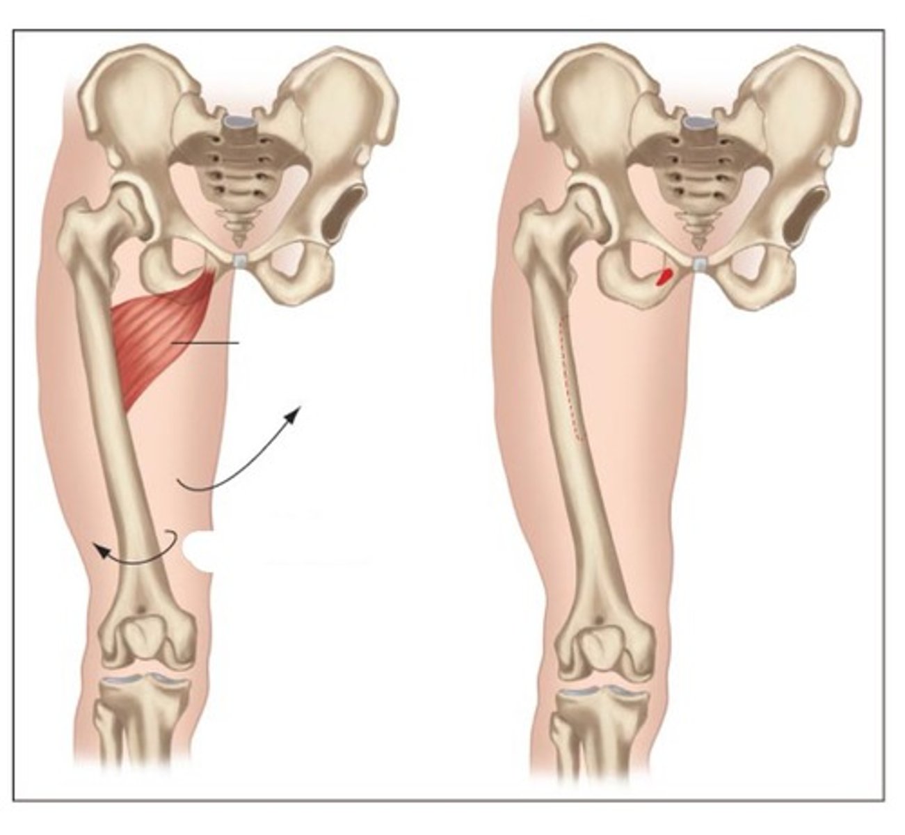 <p>Inferior ramus of the pubis</p>