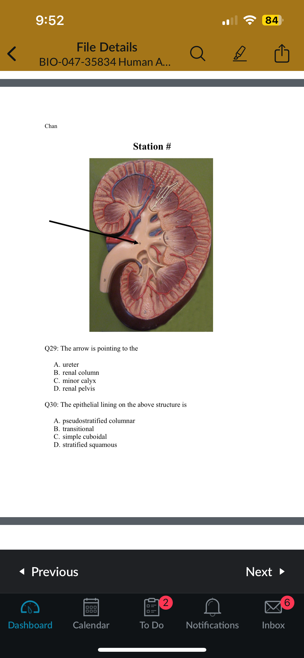 <p>Q30: The epithelial lining on the above structure is</p>