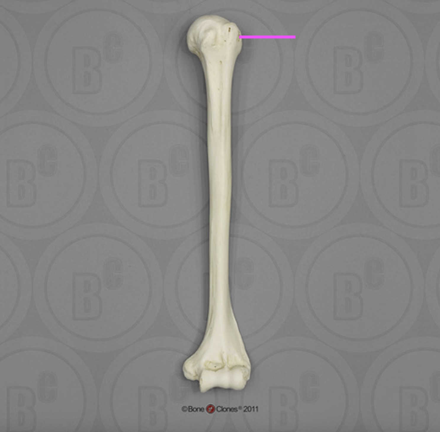<p>What part of the humerus is this?</p>