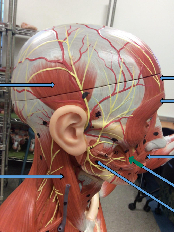 <p>Identify this muscle?</p>