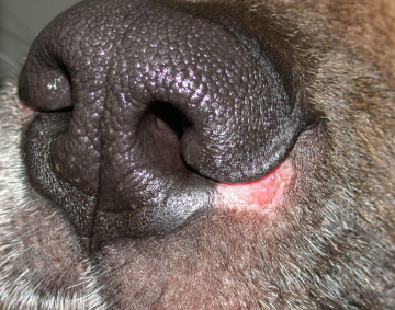 <p><span>Mucocutaneous Pyoderma</span></p>