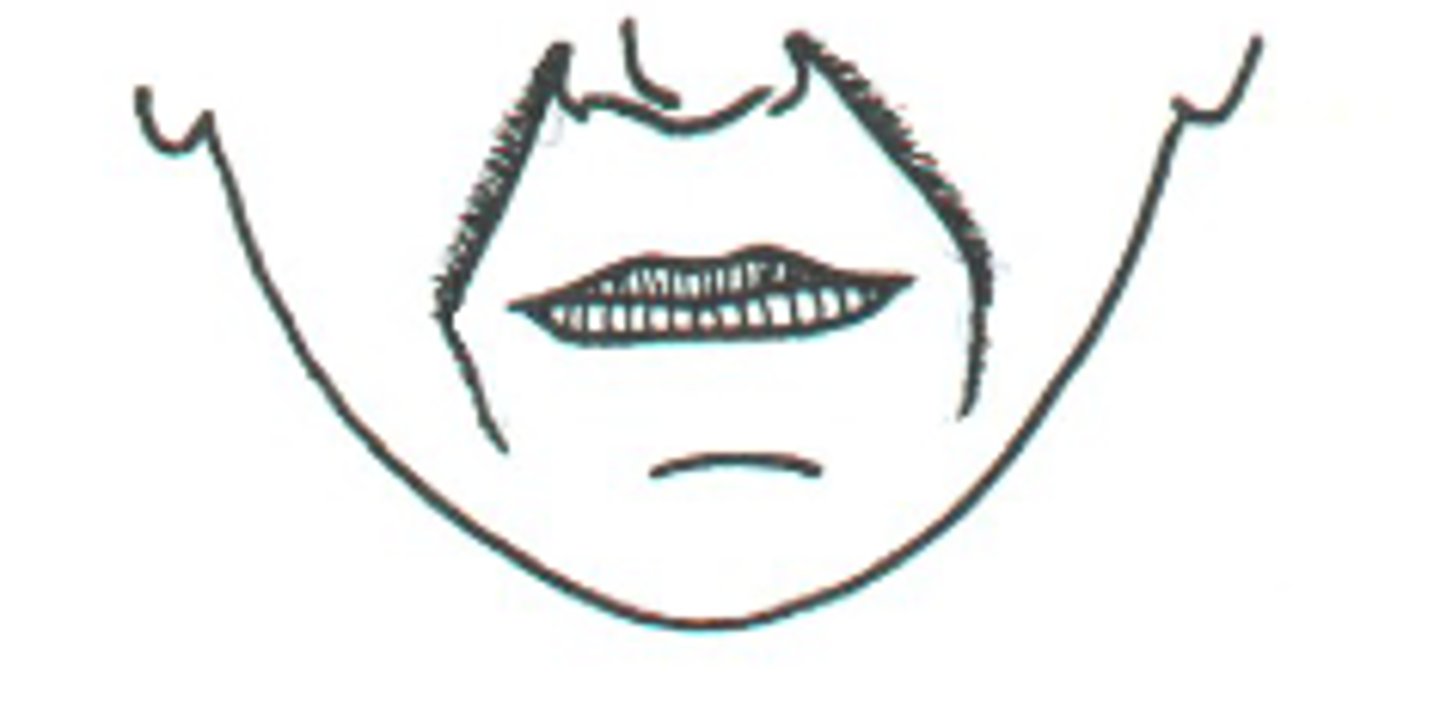 <p>usually full curved- form may continue to the jawline and border heavy jowls at sides of chin</p>