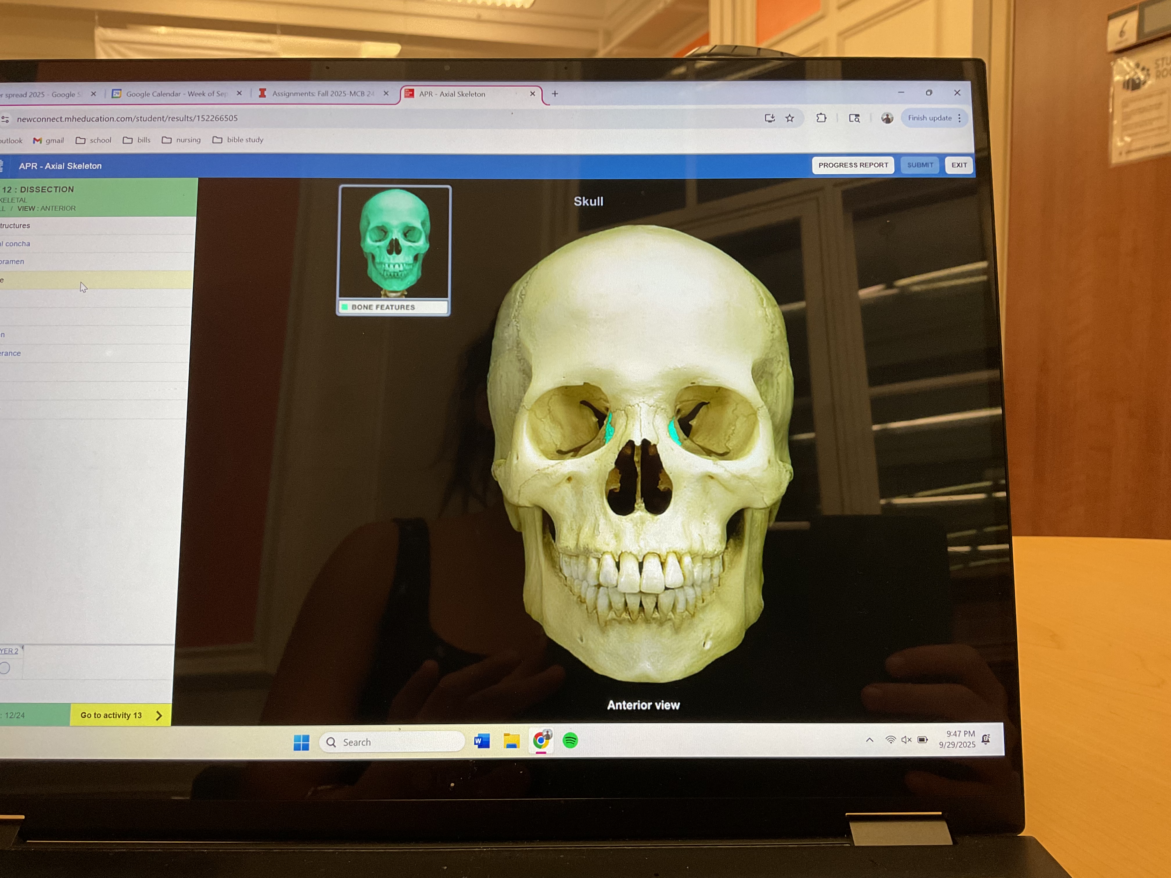 <p>Lacrimal bone </p>