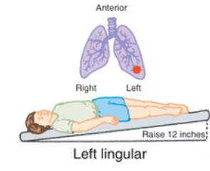 <p>What CPT position is pictured, and when is it used?</p>