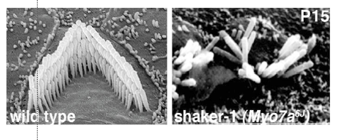 <p><span>Mutations in Dystrophin gene, an actin-associated protein cause Duchenne and Becker Muscular Dystrophy</span></p><p><span>Myosin VII mutations cause Usher’s Syndrome – hereditary deafness and blindness; the former involving defective <strong>stereocilia </strong>in the ear</span></p><p></p>