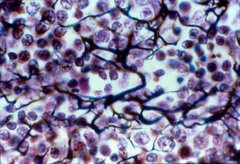 Forms the framework for organs like the liver or spleen; contains reticular cells, in lymphoid organs.