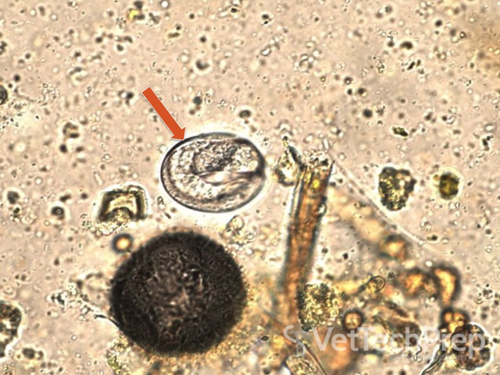 <p>what parasite is this?</p>