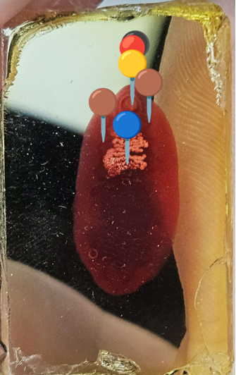 <p><span data-name="butterfly" data-type="emoji">🦋</span><span data-name="seedling" data-type="emoji">🌱</span><span><span> </span></span><strong><em>Fasciolopsis buski </em></strong><sub>(Postać dojrzała)</sub></p><p></p><p></p><p><span>🧩🦠 </span><strong>Organelle:</strong></p><p></p><ul><li><p><span>⚫️ - przyssawka gębowa;</span></p></li></ul><p></p><ul><li><p><span>🔴</span> - gardziel i przełyk;</p></li></ul><p></p><ul><li><p><span>🟡️ - przyssawka brzuszna;</span></p></li></ul><p></p><ul><li><p><span>🔵</span> - macica z jajami;</p></li></ul><p></p><ul><li><p><span>🟤</span> - jelita bez rozgałęzień.</p></li></ul><p></p><p></p><p><span>😷❓ </span><strong>Parazytoza:</strong><em> Fascjolopsoza</em></p>