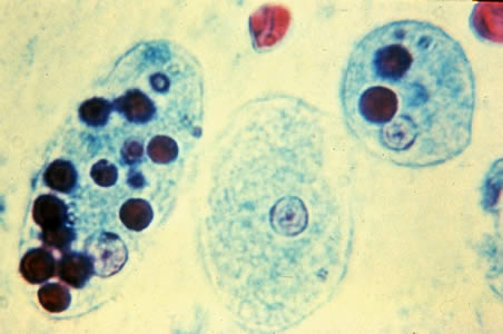 <p>Entamoeba histolytica trophozoite</p>