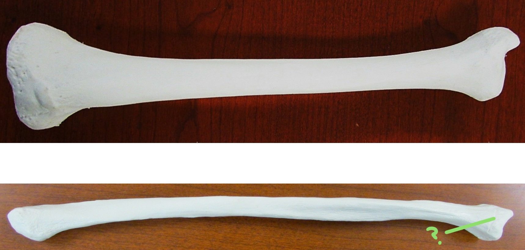 <p>Determine the part of the Fibula highlighted</p>
