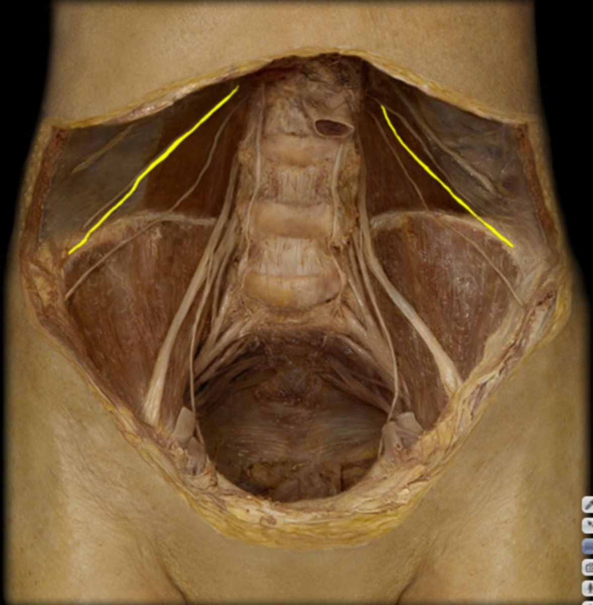 <p>Internal oblique</p>