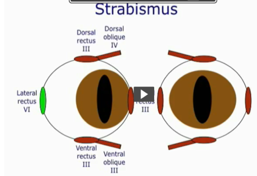 <ul><li><p>medial</p></li></ul><p>Muscle = lateral rectus</p><p></p>