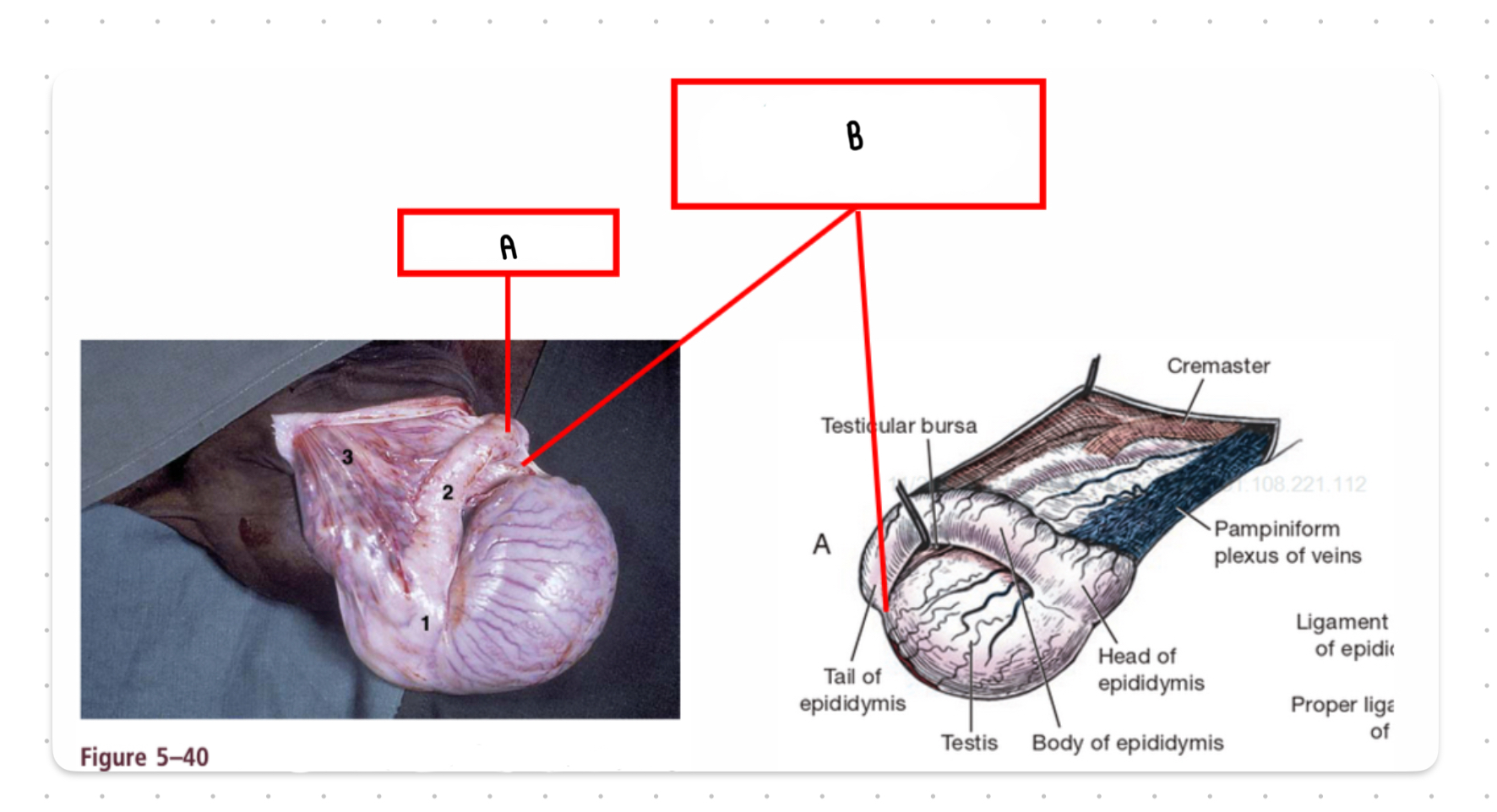 <p>What is the structure labeled A?</p>