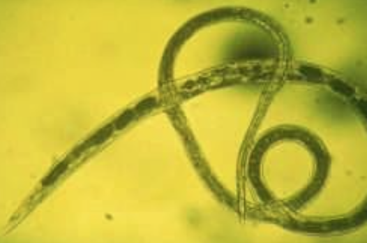 <p>Identify the parasite.</p>