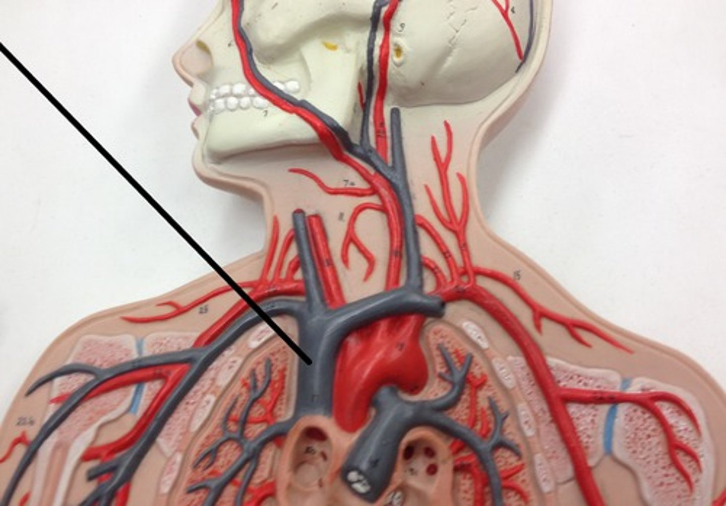 <p>What structure?</p>