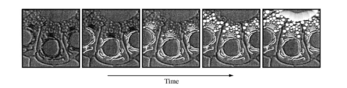 <p>crosses the endoplasmic reticulum membrane as it is translated, then moves to the Golgi apparatus, then to vesicles from which it is secreted</p>