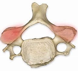 <p>What structure of the vertebra is this? </p>