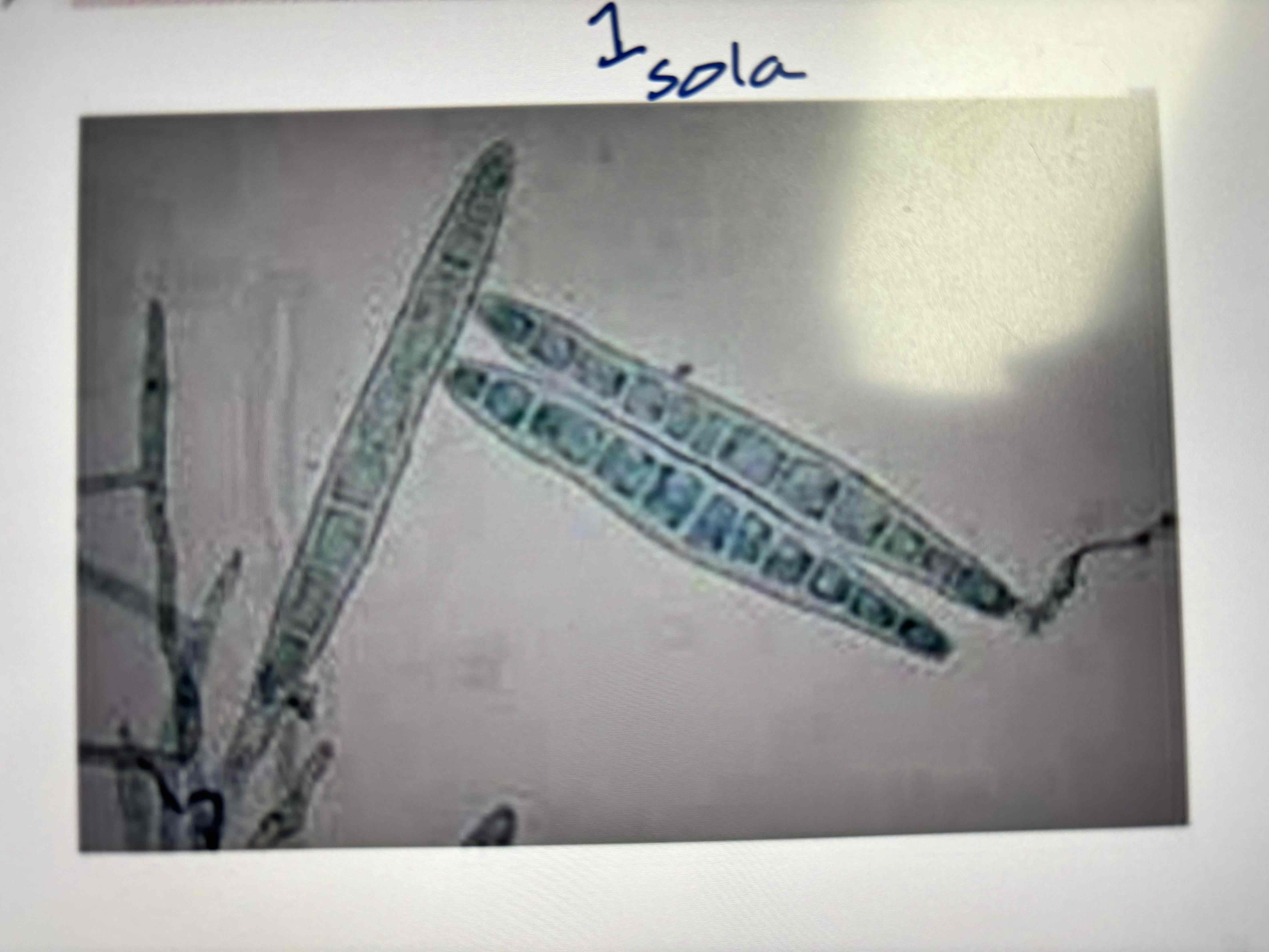 <p>Aleuriosporas</p>