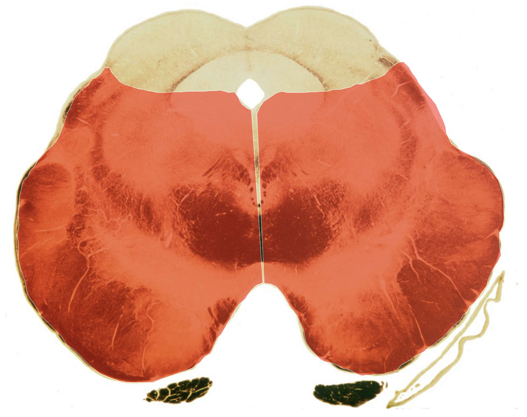 <p>Identify??</p>