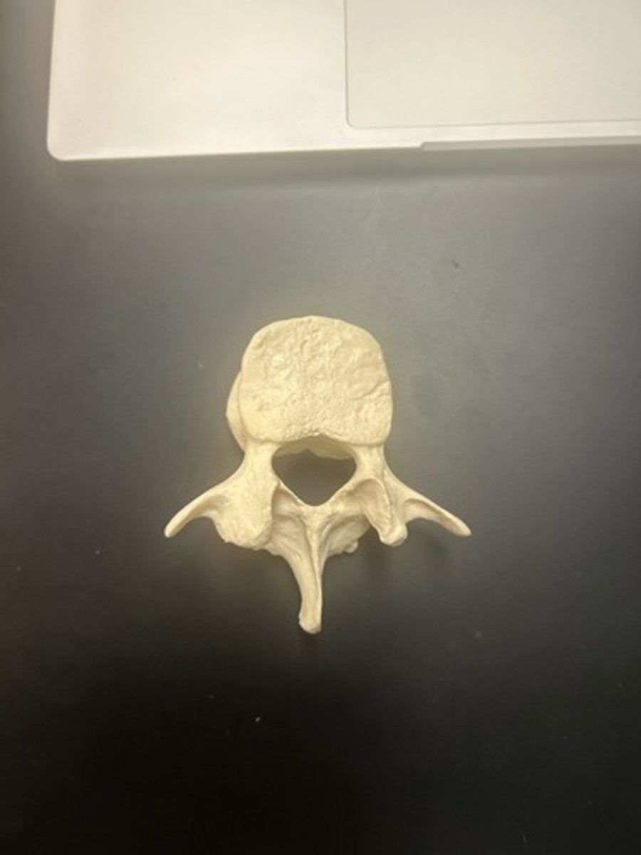 <p>name the bone</p>