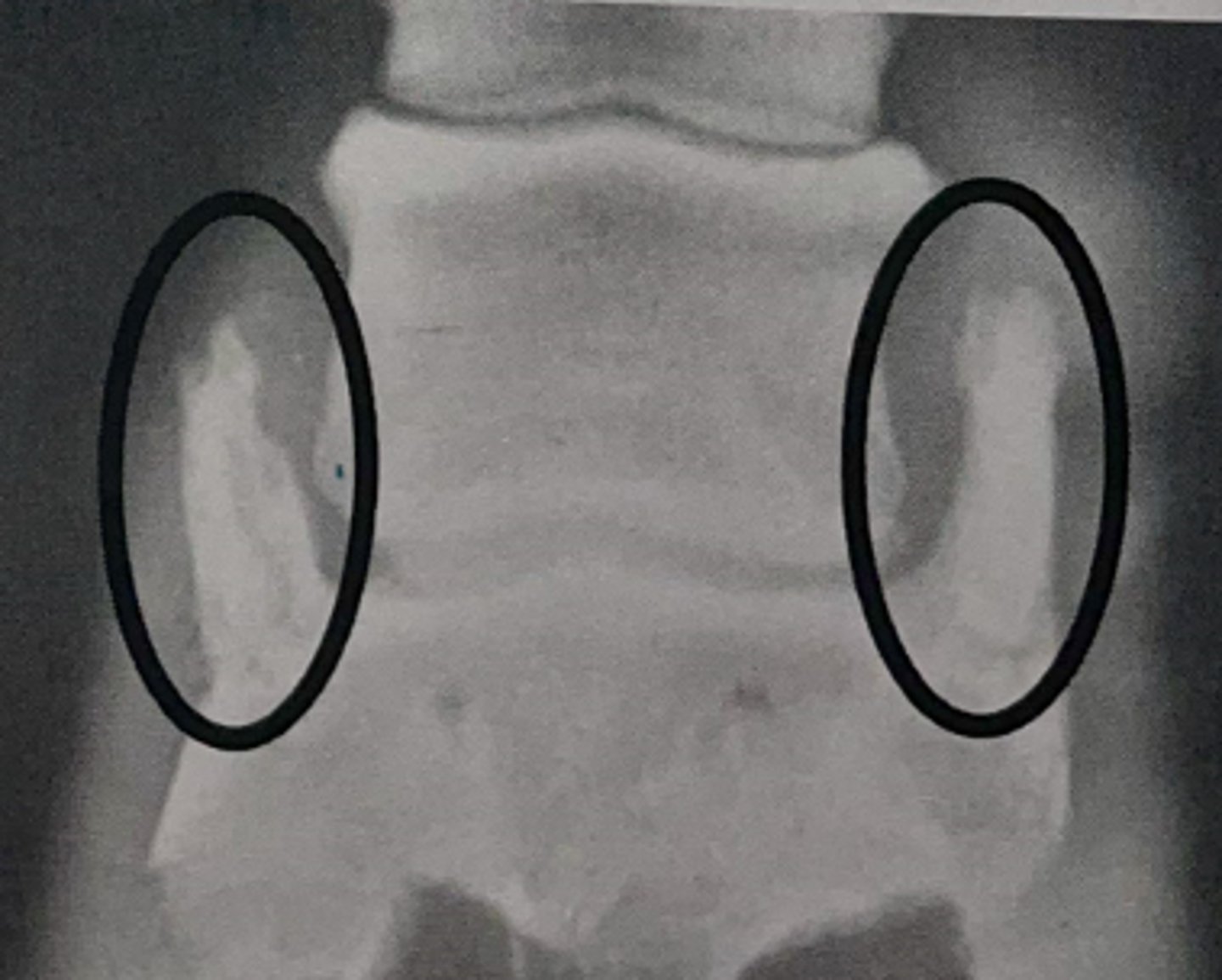 <p>Which structure in this radiograph is ossified</p>