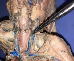 <p>What is the arrow pointing to? What’s it function? </p>