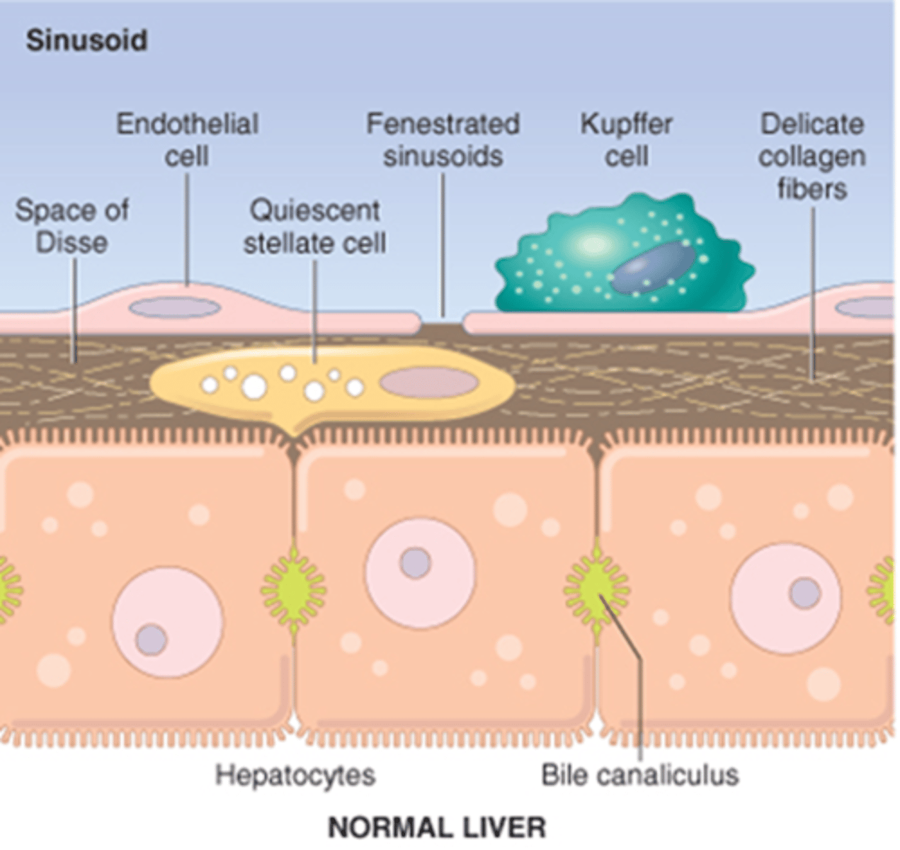 <p>Contains collagen fibres - collagen 3. Between hepatocytes and blood vessels. If scarring occurs, blocks comms between bile and capillaries.</p>