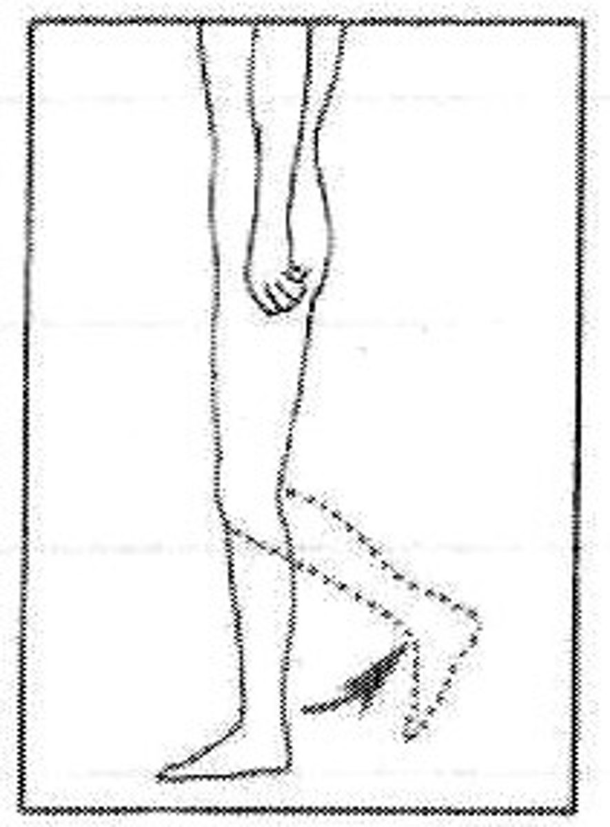 <p>what movement</p>