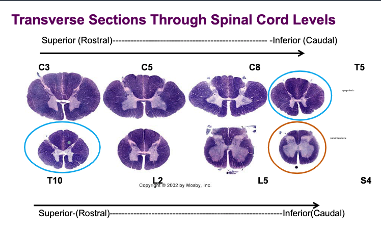 <p>Preganglionic parasympathetic neurons for the pelvic viscera found in S2-S4. Which area are they located in?</p>