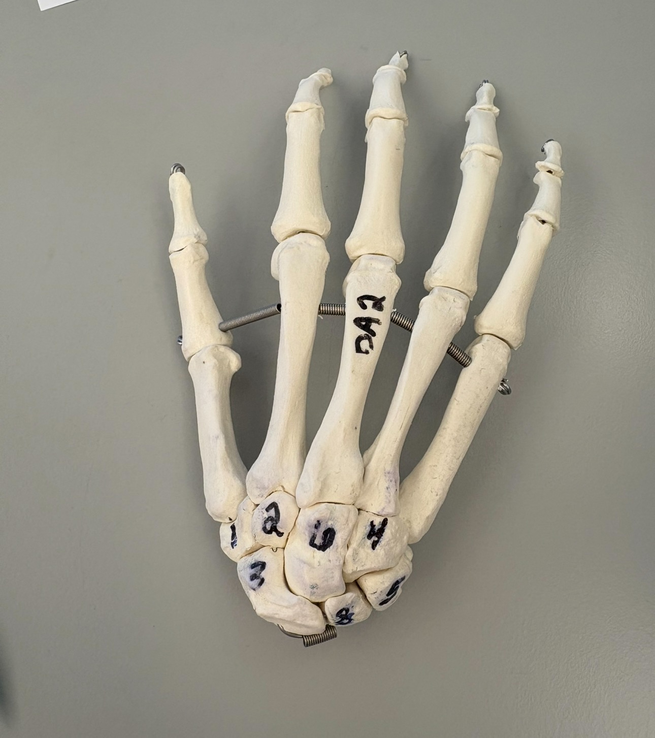<p>what does 6 indicate?</p>