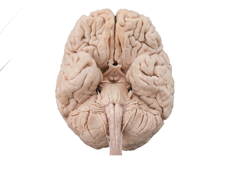 <ul><li><p>Name each cranial nerve and list the type of nerve as well as its basic function (with stars)</p></li></ul><p></p>