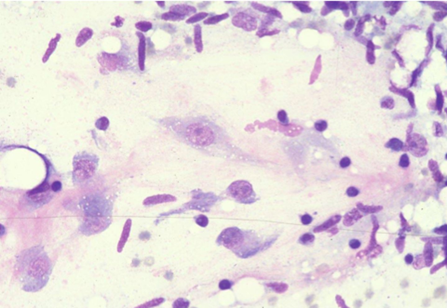 <p>Identify the type of tissue?</p>