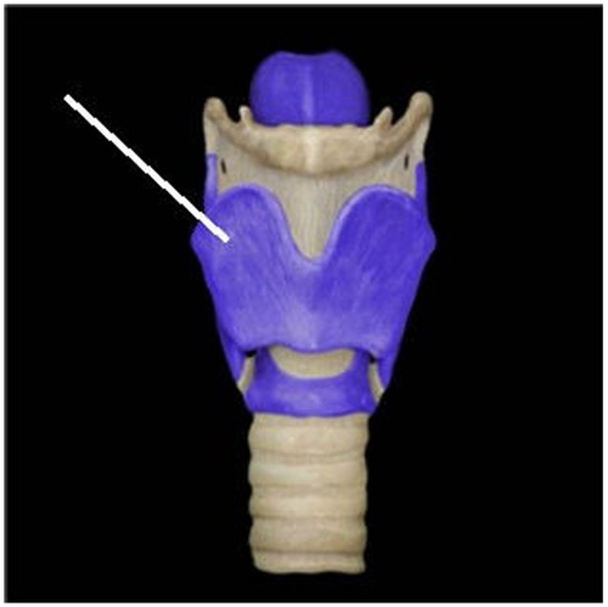 <p>Which structure is highlighted (reference leader line)?</p><p>A) laryngeal cartilages</p><p>B) hyoid bone</p><p>C) thyrohyoid ligament</p><p>D) tracheal cartilages</p><p>E) cricothyroid ligament</p>