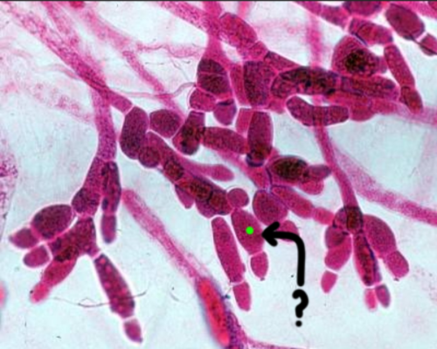 <p>Produces female gametes (egg cells) and typically larger and more prominent than male gametangia.</p>