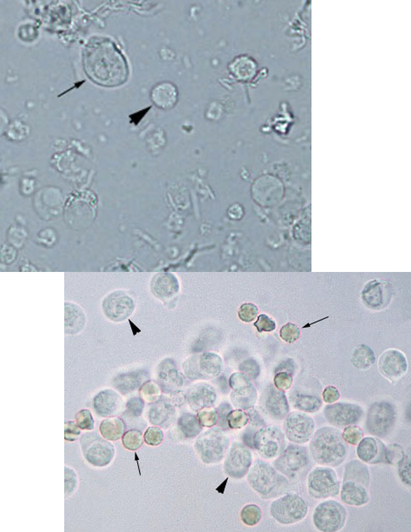 <p>What broad type of cell is shown in these images of urine?</p>