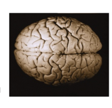 <p>What view of the brain is this</p>